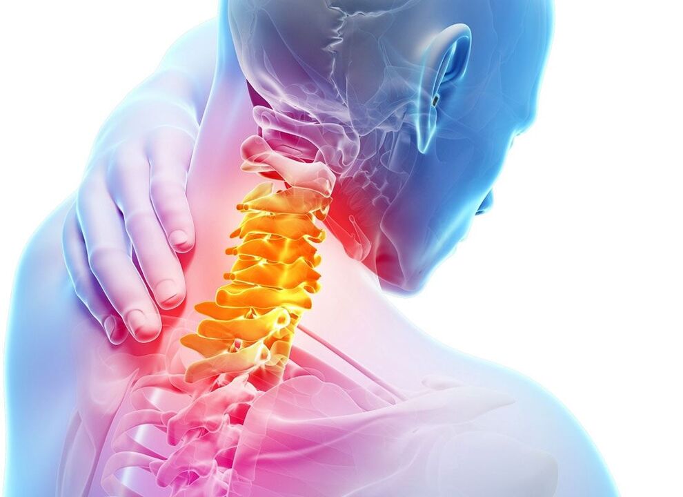 localização da osteocondrose